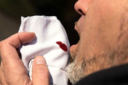 Coughing in Blood